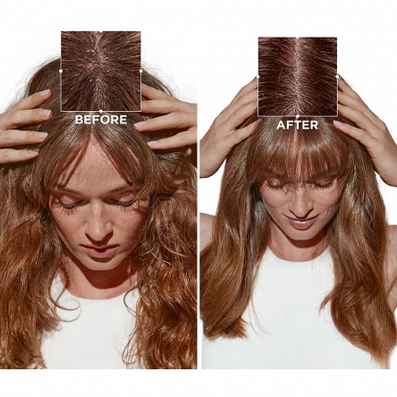 Peeling Kerastase Symbiose do wrażliwej skóry głowy ze skłonnością do łupieżu 200ml Kerastase 3474637135744