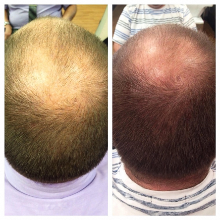 Szampon Nioxin System 2 do włosów naturalnych, oczyszczający 1000ml Szampony do włosów przetłuszczających się Nioxin 8005610494944