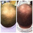 Odżywka Nioxin System 5 rewitalizująca przeznaczona do włosów po zabiegach chemicznych 1000ml Odżywki do włosów zniszczonych Nioxin 3614227273443