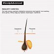 Szampon Loreal Scalp Advanced Dermo-Regulator do wrażliwej skóry głowy 300ml L'Oreal Professionnel 3474637090470