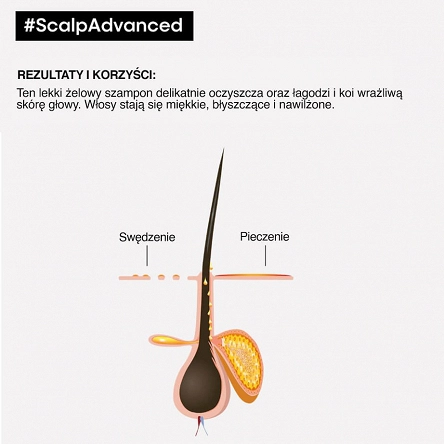 Szampon Loreal Scalp Advanced Dermo-Regulator do wrażliwej skóry głowy 300ml L'Oreal Professionnel 3474637090470